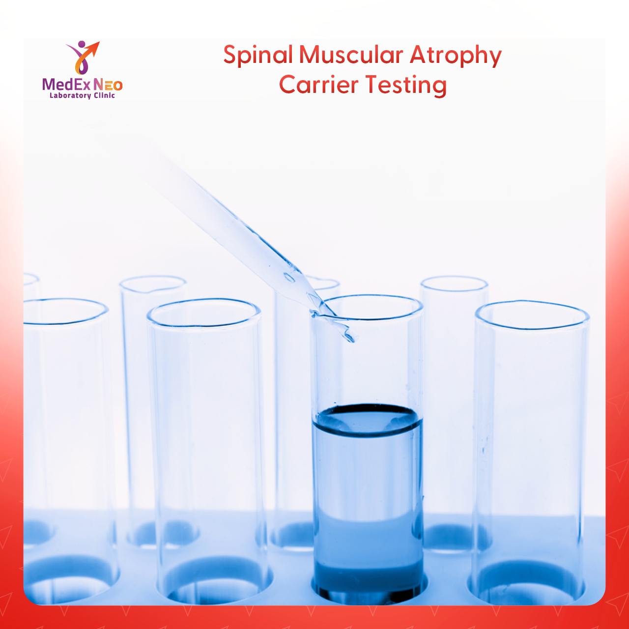 Spinal Muscular Atrophy Carrier Testing - Medex